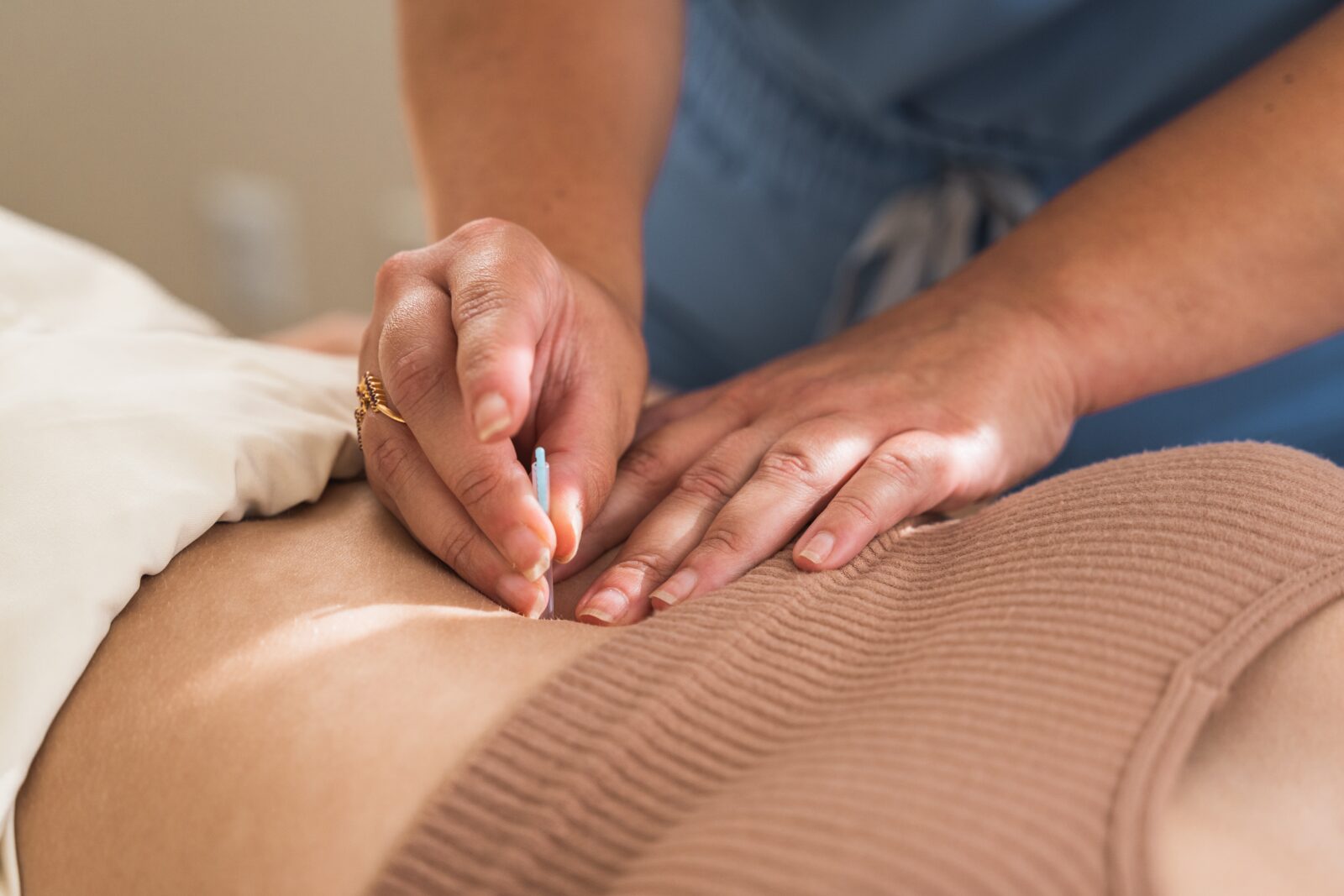 a person receiving acupuncture